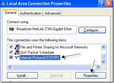local area connection